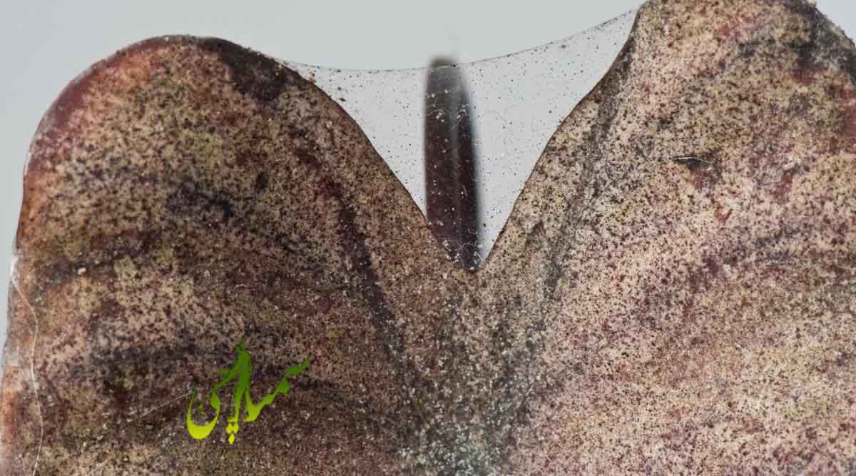 تار عنکبوت